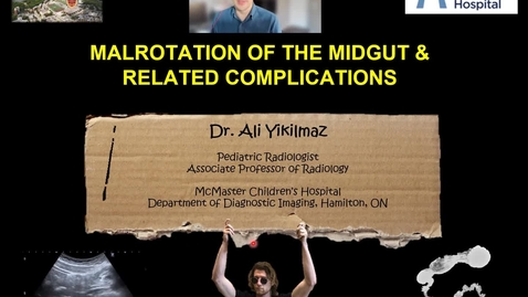 Thumbnail for entry Malrotation and midgut volvulus