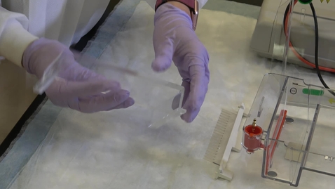 Thumbnail for DNA agarose gel