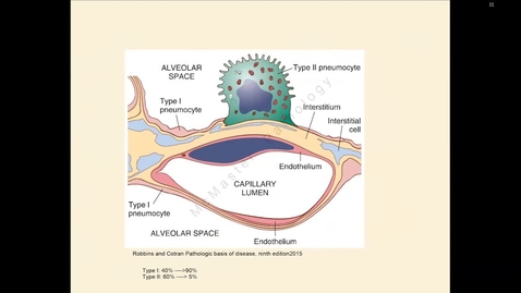 Thumbnail for entry A Cloudy Diagnosis: a multidisciplinary approach exemplar | Dr. Kevan Mehta, Dr. Yongdong Wang &amp; Dr. Jorge Arredondo | August 18, 2022