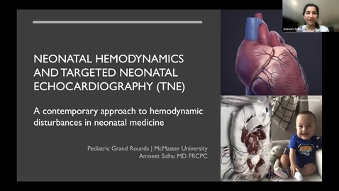 Thumbnail for entry Neonatal Hemodynamics and Targeted Neonatal Echocardiography (TNE): A contemporary approach to hemodynamic disturbances in neonatal medicine | Dr. Amneet Sidhu | February 16, 2023