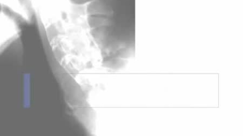 Thumbnail for entry PathologyModule_ AnkylosingSpondylitis