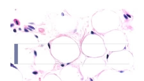 Thumbnail for PathologyModule_Obesity