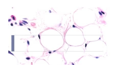 Thumbnail for entry PathologyModule_Obesity