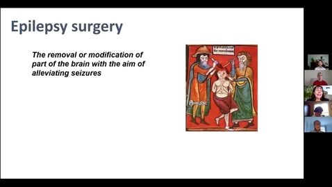 Thumbnail for entry Epilepsy Surgery The Earlier the Better, Dr. Helen Cross, April 9 2021