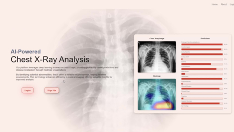 Thumbnail for AI powered Chest Xray Analysis - Computer Science