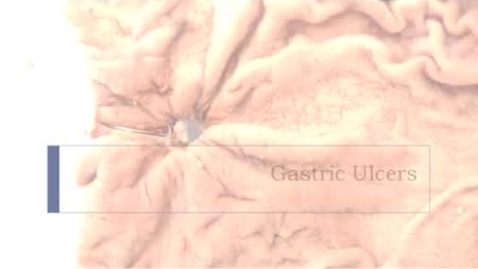 Thumbnail for entry PathologyModule_GastricUlcers