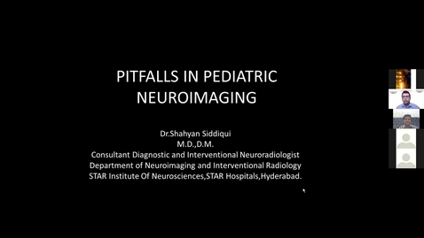 Thumbnail for entry Pitfalls in Pediatric Neuroimaging, Dr. Shahyan Siddiqui, Dec 10 2021