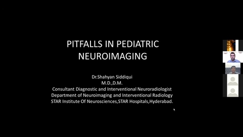 Thumbnail for Pitfalls in Pediatric Neuroimaging, Dr. Shahyan Siddiqui, Dec 10 2021