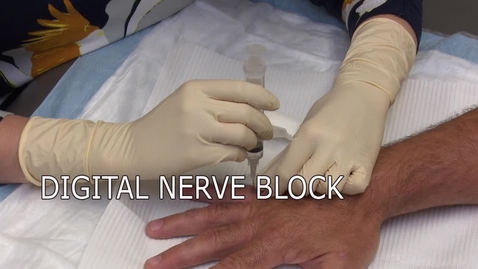 Thumbnail for entry Digital Nerve Block