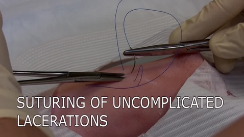 Thumbnail for entry Suturing of Uncomplicated Lacerations