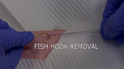 Thumbnail for Fish Hook Removal