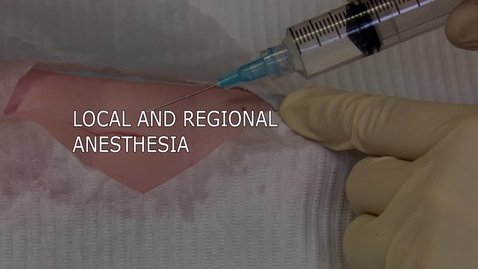 Thumbnail for entry Local and Regional Anesthesia
