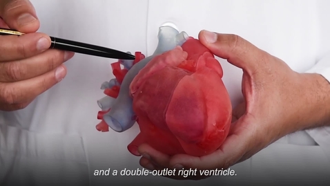Thumbnail for Planning a Double Switch Procedure: Using a 3D Printed Heart