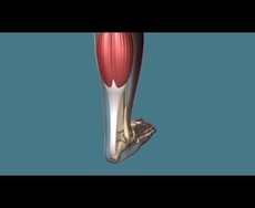 Achilles tendon popping sensation deals