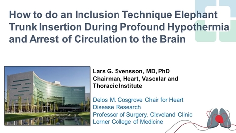 Thumbnail for Inclusion Technique Elephant Trunk Insertion during Profound Hypothermia and Arrest of Circulation to the Brain