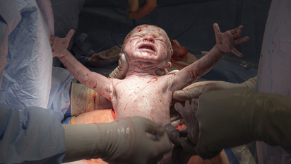 Born Without A Uterus Woman Gives Birth After Uterus Transplant
