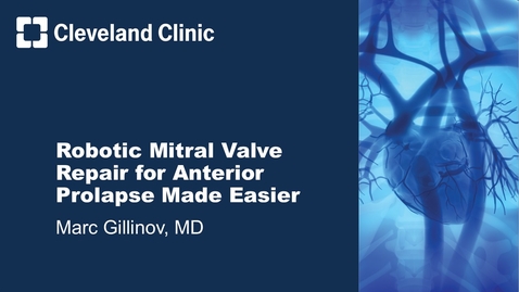 Thumbnail for Robotic Mitral Valve Repair for Anterior Prolapse Made Easier (Graphic)