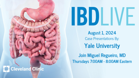 Thumbnail for IBD Live - Aug. 1, 2024