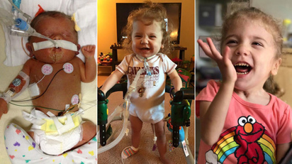 Hydrops Baby  : A Miracle Story of Survival