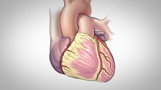 coronary artery bypass surgery