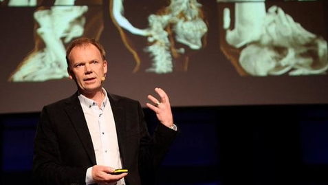 Thumbnail for Visualizing the medical data explosion | Anders Ynnerman