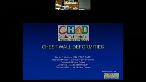Thumbnail for entry Chest Wall Deformity