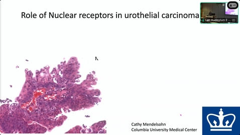 Thumbnail for Role of nuclear receptors in bladder cancer