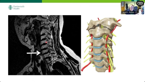 Thumbnail for 1/6/25 Topics in Medicine and Surgery - I've Got Your Back!  Part One - Presented by Sarah Britton, APRN