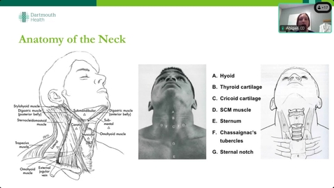 Thumbnail for 8/5/24 Topics in Medicine and Surgery - Neck Masses - Presented by Abigail Driest PA-C, Otolaryngology Fellow