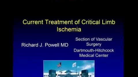 Thumbnail for Current Treatment of Critical Limb Ischemia