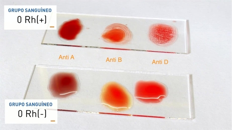 Miniatura para la entrada Determinación de grupos sanguíneos humanos