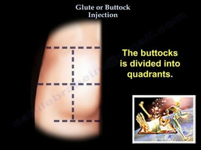 MA210L Week 3: Glute injection - Everything You Need To Know - Dr ...