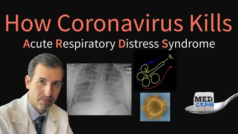 Thumbnail for entry How Coronavirus Kills: Acute Respiratory Distress Syndrome (ARDS) &amp; COVID-19 Treatment