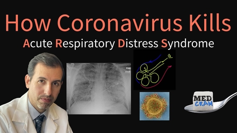 Thumbnail for How Coronavirus Kills: Acute Respiratory Distress Syndrome (ARDS) &amp; COVID-19 Treatment