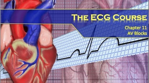 Thumbnail for entry The ECG Course - AV Blocks (The Resuscitationist)