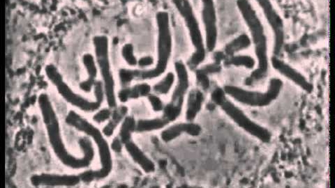 Thumbnail for Mitosis Blood Lily