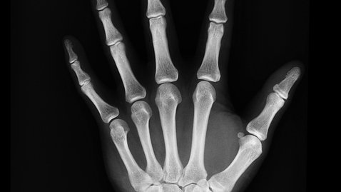 Thumbnail for AI Augmented X-Ray Imaging Schellenberg, Tascan