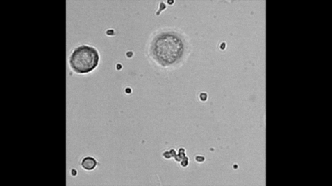 Thumbnail for blood-disorder-mh9-cells-1080