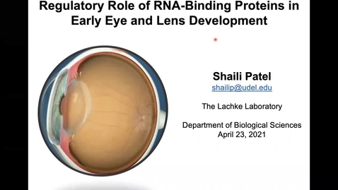 Thumbnail for entry Regulatory role of RNA-binding proteins in eye and lens development, Shaili Patel