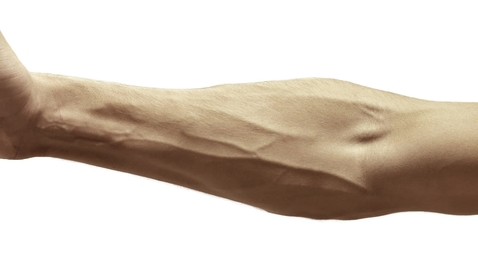 Thumbnail for Obtaining a Blood Specimen