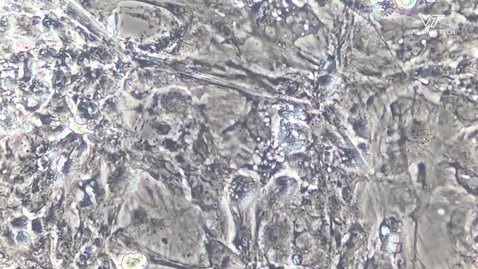 Thumbnail for entry Fralin Biomedical Research Institute researchers discover link between blood chemistry and deadly heart arrhythmias