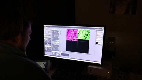 Thumbnail for Collaborative grant takes on brain cancer