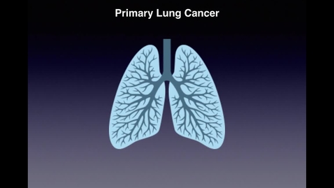 Thumbnail for entry Lung Cancer