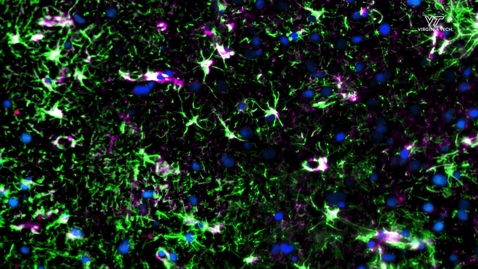 Thumbnail for Virginia Tech researcher’s 3D model of brain tumor environment could aid personalized treatment
