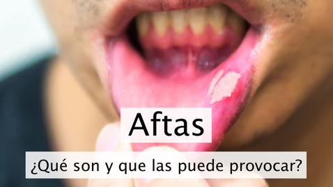 Miniatura para Aftas