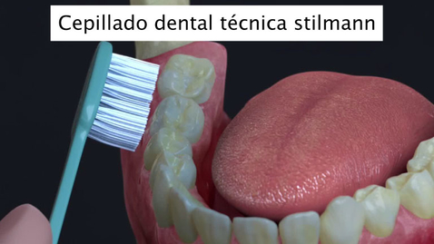 Miniatura para Cepillado dental técnica stilmann