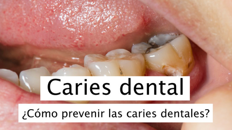 Miniatura para Caries dental