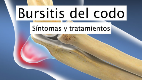 Miniatura para Bursitis del codo
