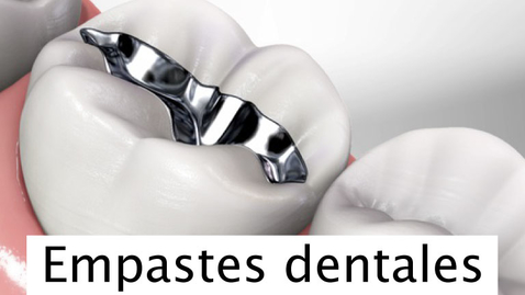 Miniatura para Empastes dentales