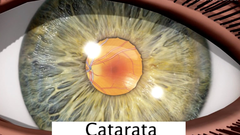 Miniatura para cataratas